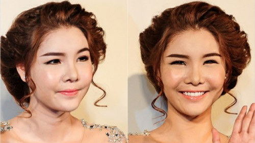 Trong một sự kiện tháng 7 năm nay, Kỳ Hân khiến công chúng bất ngờ với gương mặt sưng vù. Cô lên tiếng cho hay vì uống nhiều thuốc cảm dẫn đến bị dị ứng.