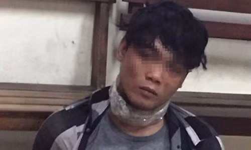 Nhung lan thoat luoi cong an “nhu phim” cua ke cuop