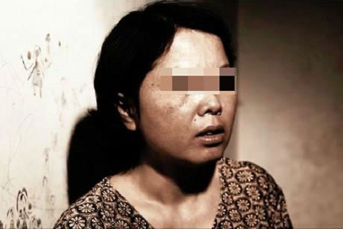 Co giao tre sung so khi biet nguyen nhan bi ung thu phoi