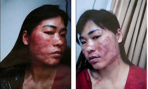 Bi chong thue nguoi rach nat mat vi doi tien nuoi con