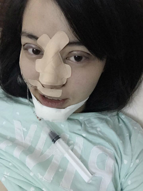 Cô bạn chia sẻ: “Làm đẹp là một cái quyền tối thiểu của con người, đặc biệt là phụ nữ. Nhưng nếu phẫu thuật thẩm mỹ trước khi kết hôn sẽ ảnh hưởng rất nhiều tới sức khỏe của thai nhi khi mang bầu, vì thế mình đã phải đợi sinh hạ bé Táo, rồi mới phẫu thuật thẩm mỹ”.