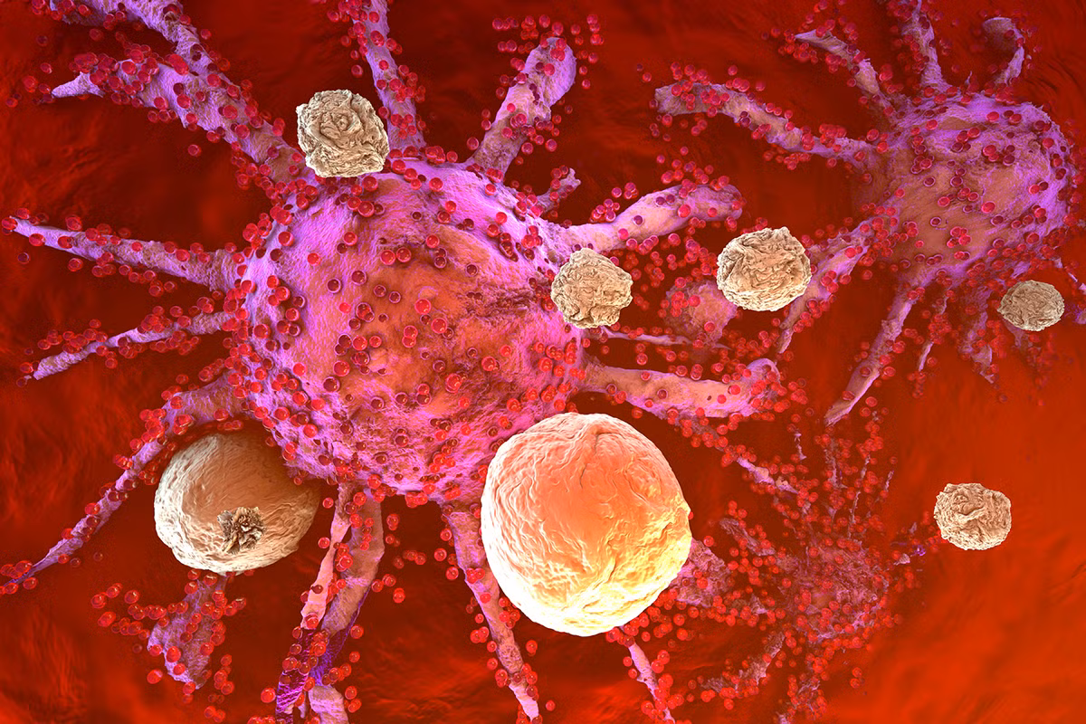 Cơ thể nhanh chóng trở thành hệ sinh thái cho vi khuẩn, khi hệ miễn dịch ngừng hoạt động. (Ảnh: Alliance for Cancer Gene Therapy)