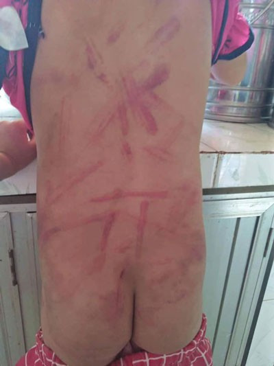 Chau be 6 tuoi bi ba dung roi danh bam tim khap nguoi