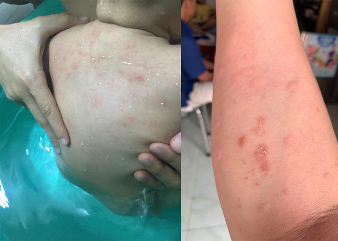 Nuoc may chung cu Prosper Plaza vang khe do cong ty nuoc nao cung cap?