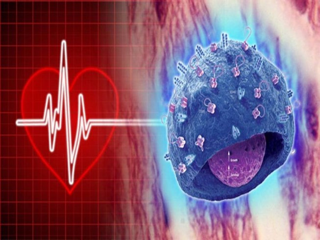 Trường hợp khác là của một người đàn ông 47 tuổi. Sau ca ghép tim phức tạp và nguy hiểm, ông trở nên say mê những bản nhạc cổ điển, đặc biệt là những bản nhạc viết cho đàn violon dù trước ca phẫu thuật ông là người "mù" âm nhạc.