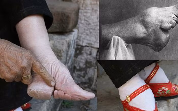 Dưới thời phong kiến, tục bó chân khá phổ biến đối với phụ nữ Trung Quốc để kiểm soát và củng cố đức hạnh của nữ giới. Với mong muốn sở hữu đôi chân "gót sen ba tấc", các cô gái thực hiện tập tục bó chân vô cùng đau đớn và nguy hiểm từ khi chưa đến 10 tuổi.