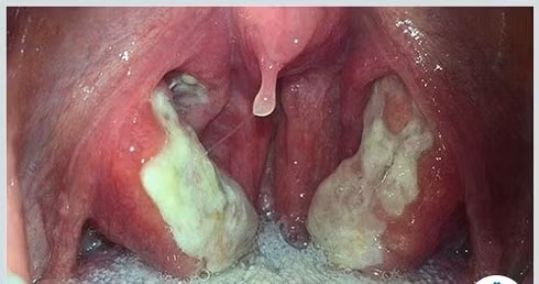 Thanh nien sot cao, nam bep, khong an uong gi chi boi thoi quen nay