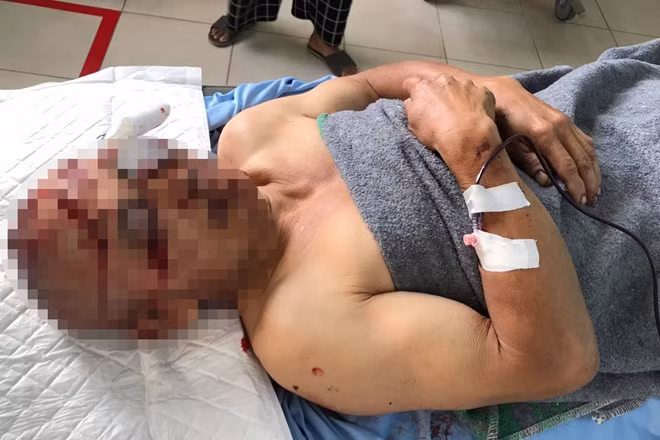  4. Nhân viên đang ngủ bị cướp chém trọng thương: Rạng sáng 29/8, ông Quách Văn Dĩnh (SN 1967, quê Hòa Bình) đang ngủ tại quán giải khát Hòa Bình, khu du lịch Quốc gia hồ Tuyền Lâm (TP Đà Lạt) thì bất ngờ bị một đối tượng xông vào chém tới tấp. Tại cơ quan điều tra, tên cướp khai là Nguyễn Công Phúc (SN 2000, quê Bình Định), do làm ăn thua lỗ không có tiền trả nợ nên đã ra ra tay sát hại ông Dĩnh để cướp tài sản. 