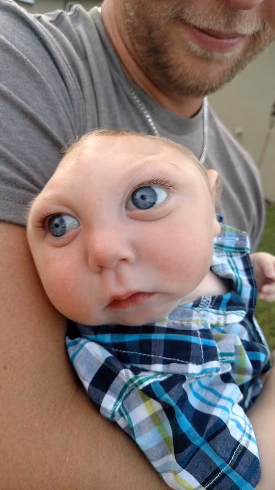 Nhưng Jax Strong, biệt danh được các cư dân mạng đặt cho Jaxon giờ đã tròn 1 tuổi. Câu chuyện của cậu bé đã thu hút được sự chú ý của nhiều gia đình trên khắp nước Mỹ, với ​107.576 người "thích" trang Facebook của cậu bé và 18.000 người chia sẻ câu chuyện của cậu.