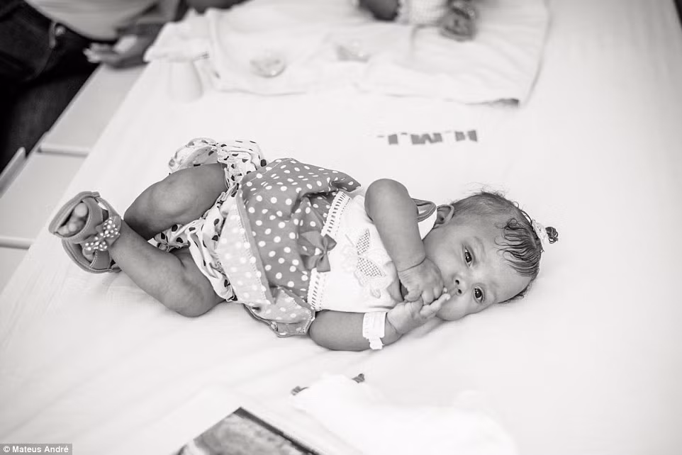 Bé Marie Eduarda khỏe mạnh chỉ vài tuần sau ca phẫu thuật tách rời.