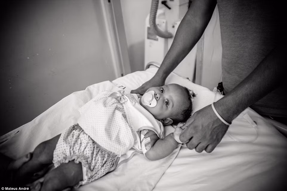 Bé Marie Clara chuẩn bị được kiểm tra X-quang sau ca phẫu thuật.