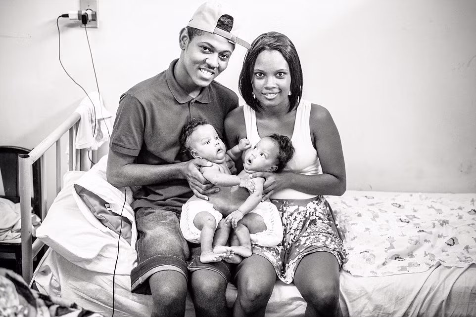 Trước đó, nhiếp ảnh gia Mateus André, 28 tuổi, đến từ Brazil, đã chụp bộ ảnh 2 bé chưa tách rời, vận động quyên góp từ thiện cho ca phẫu thuật. Mateus cho biết ông muốn sử dụng nhiếp ảnh để khiến cộng đồng chú ý hơn đến những em bé bị khuyết tật thể hình hoặc trí tuệ như Maria Clara và Maria Eduarda Oliveira Santana, mong rằng sẽ sớm có một phép màu đến với hai cô bé.