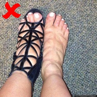 Một đôi giày cao gót có dây buộc sẽ ảnh hưởng đến việc lưu thông máu ở bàn chân. Chưa kể việc cọ xát giữa da và dây giày có thể gây ra các vấn đề về da như ngứa, mẩn đỏ hoặc nổi mụn nước. Dù đẹp đến đâu bạn cũng nên hạn chế “rước” em này về nhé! 