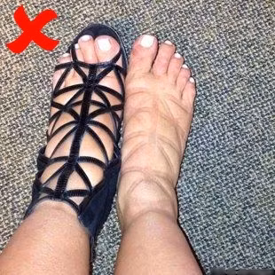 Một đôi giày cao gót có dây buộc sẽ ảnh hưởng đến việc lưu thông máu ở bàn chân. Chưa kể việc cọ xát giữa da và dây giày có thể gây ra các vấn đề về da như ngứa, mẩn đỏ hoặc nổi mụn nước. Dù đẹp đến đâu bạn cũng nên hạn chế “rước” em này về nhé! 
