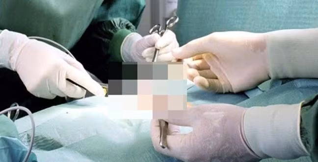  Bị vợ dùng dao cắt "của quý" ném xuống kênh nước: Ngày 18/2/2017, sau khi ăn uống no say, người chồng quay về nhà ngủ. Thời điểm này, chị Lê Thị Mỹ Chi (SN 1983, ngụ huyện Tân Thạnh, Long An) thức dậy. Nghi ngờ chồng ngoại tình nên Chi đã lấy con dao cắt ngang “của quý” chồng rồi vứt xuống con kênh gần nhà. Sau đó nạn nhân được người nhà đưa đi cấp cứu còn Chi bị Công an huyện Tân Thạnh mời lên làm việc để điều tra về hành vi cố ý gây thương tích. (Ảnh minh hoạ)