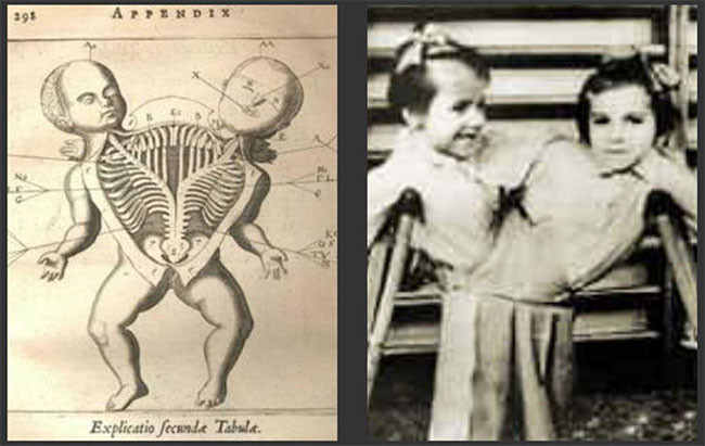 Bác sĩ "tử thần" của trại tập trung Auschwitz (Đức Quốc xã) Joseph Mengele chính là “cha đẻ” của thí nghiệm trên các cặp song sinh với mục đích tìm ra những điểm tương đồng và khác biệt trong genư của các cặp song sinh. Đã có khoảng 1.500 cặp song sinh bị đưa đến để phục vụ cho thí nghiệm. Tất cả họ đều bị nhốt trong các doanh trại suốt quá trình.