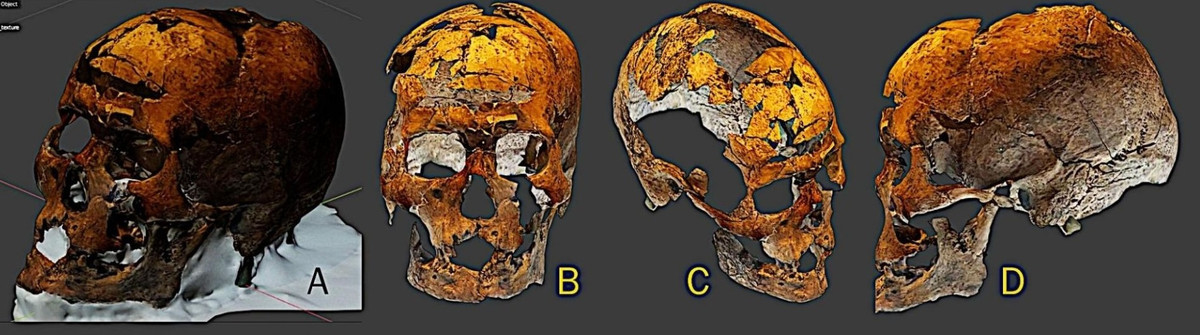 Cụ thể, theo nghiên cứu của các chuyên gia, Zuzu sống cách đây 9.600 năm. Hộp sọ của người này được trưng bày ở Bảo tàng Tự nhiên tại Paraná, Brazil.