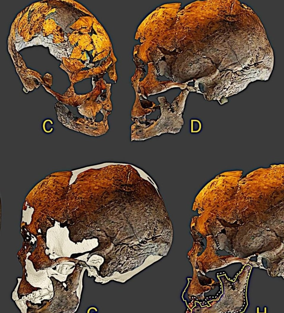 Sử dụng phép quang trắc, các chuyên gia đã kết hợp 57 bức ảnh bằng kỹ thuật số để tạo ra mô hình 3D ảo của hộp sọ nhằm tìm ra gương mặt thực sự của Zuzu - nhân vật bí ẩn và quan trọng trong lịch sử Brazil.