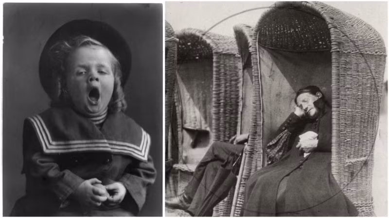 Về sau, các chuyên gia xác định căn bệnh này là "Encephalitis lethargica (EL, hay còn gọi là “bệnh ngủ”). Chứng bệnh kỳ bí này sau đó lan rộng ở châu Âu và nhiều quốc gia khác trên thế giới.