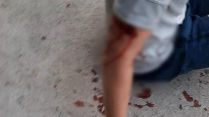 Suc khoe du khach nuoc ngoai bi cho du can o Nha Trang hien ra sao?