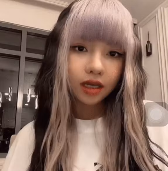 CiiN cho biết mình đã sửa mũi được 25 ngày và tổng chi phí là 150 triệu. Sở dĩ con số này cao hơn hẳn so với mặt bằng chung vì đây là lần thứ 2 cô nàng sửa mũi và ngoài nâng mũi, CiiN còn thực hiện thu gọn cánh mũi.