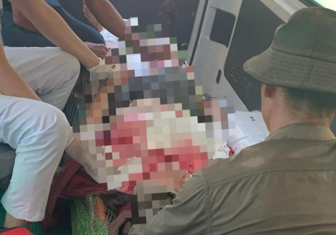 Người phụ nữ bị đá rơi trúng người khi đi dọn thực bì Nguoi phu nu bi da roi trung nguoi khi di don thuc bi