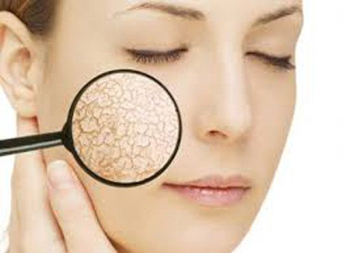 Da khô. Da là một trong những bộ phận lớn nhất cơ thể, rất cần nước để giữ ẩm. Nếu không cung cấp đủ nước, da trở nên khô, khó thoát mồ hôi khiến lớp dầu dư thừa dễ dàng tích tụ. Về lâu dài, uống ít nước khiến da khô khiến da mặt ngày càng trở nên tồi tệ, mụn mọc nhiều hơn.