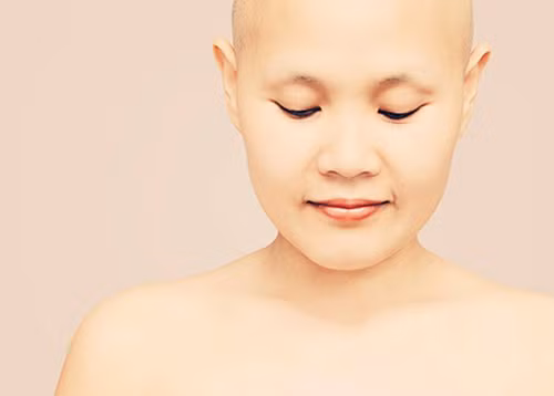 Ám ảnh về thời trang. Không chỉ mệt mỏi, bệnh nhân hóa trị ung thư vú thường bị rụng tóc, giảm cân mạnh, da khô… Điều này khiến họ cảm thấy vô cùng thất vọng về bản thân, ngoại hình.