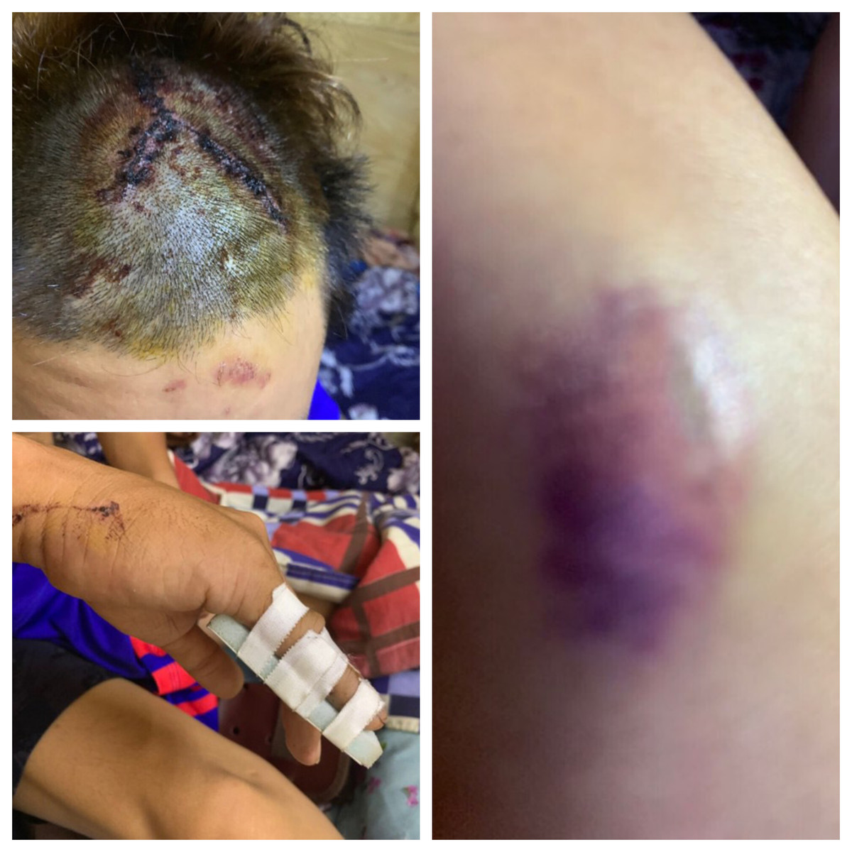 Hang chuc giang ho vao tan benh vien Cho Ray de truy sat 2 thanh nien