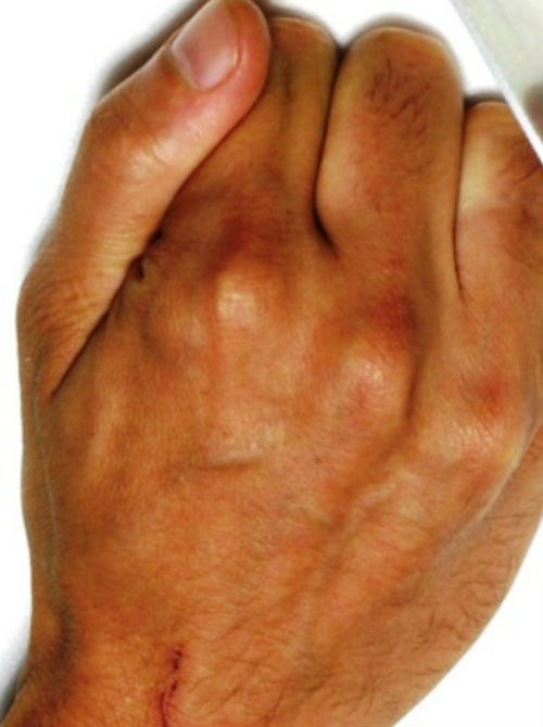 Yakuza có nhiều nghi thức kỳ lạ, trong đó có nghi thức chặt ngón tay út để thể hiện sự sám hối hoặc gửi lời xin lỗi.