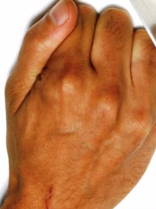 Yakuza có nhiều nghi thức kỳ lạ, trong đó có nghi thức chặt ngón tay út để thể hiện sự sám hối hoặc gửi lời xin lỗi.