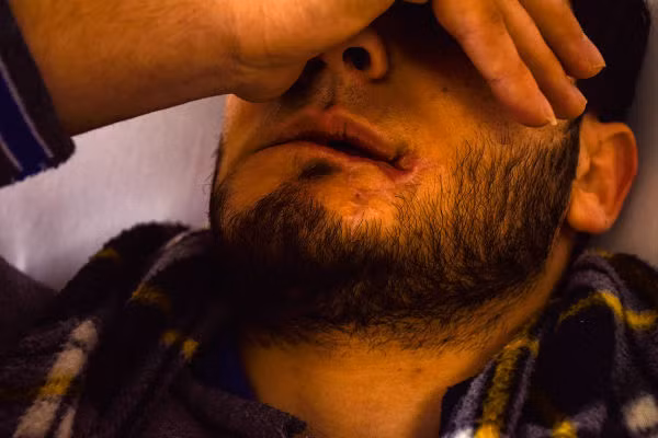 Gương mặt của người đàn ông này đã bị biến dạng.