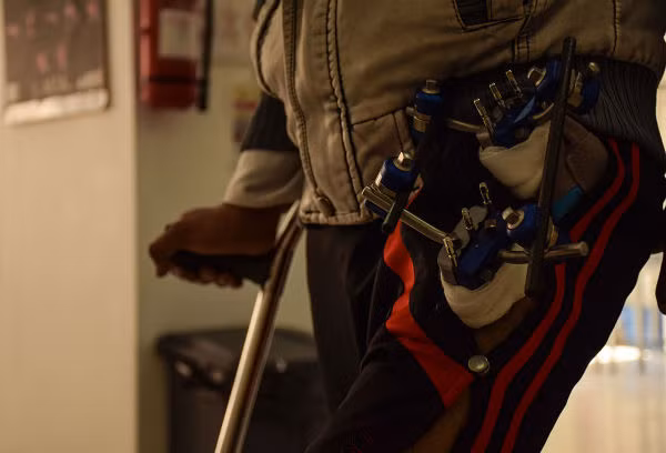 Nạn nhân người Yemen này bị thương trong một cuộc không kích của liên quân Ả-rập.