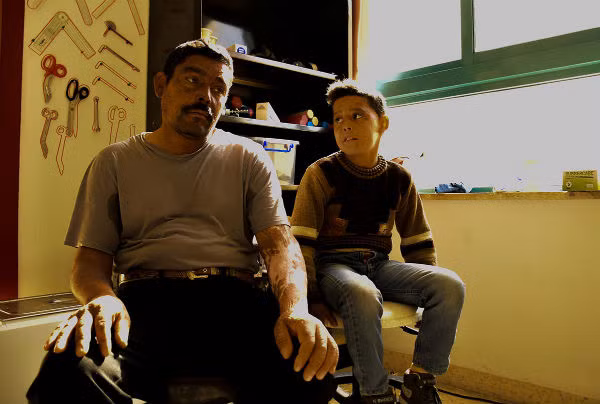 Bệnh viện Mowasah ở thủ đô Amma, Jordan, phẫu thuật chỉnh hình miễn phí cho nhiều nạn nhân trong cuộc chiến tranh ở Trung Đông. Hiện, tòa nhà 5 tầng này đang tiếp nhận hơn 140 bệnh nhân, gần 2/3 trong số họ đến từ Syria. Trong ảnh là Aiman Abou Quias và con trai của ông.