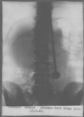 Để kiểm chứng bản thân không sử dụng kỹ xảo, Mirin Dajo đồng ý cho các bác sĩ tiến hành kiểm tra, trong đó có việc chụp X-quang ngay tại hiện trường. Kết quả kiểm tra cho thấy Mirin Dajo thực sự bị dao, kiếm đâm xuyên qua cơ thể.