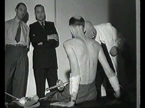 Ngay cả khi rút thanh kiếm hoặc dao ra khỏi cơ thể, Mirin Dajo cũng không có cảm giác đau đớn.