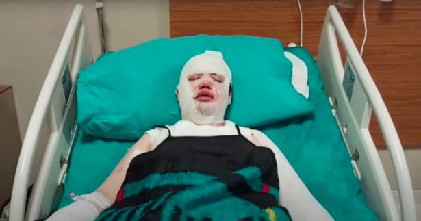 Nguoi phu nu dang thuong bi chong cu doi nuoc soi khi dang ngu-Hinh-2