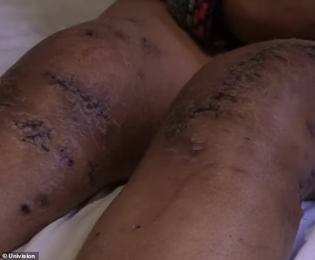 Bị sư tử tấn công, người phụ nữ liều mạng cắn lại con vật - Hình 2 Bi su tu tan cong, nguoi phu nu lieu mang can lai con vat-Hinh-2