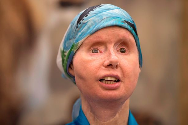 Nguoi phu nu “hoi sinh” sau khi bi tinh tinh tan cong kinh hoang-Hinh-3