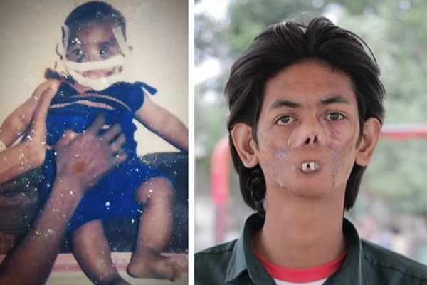 Cau be co guong mat bien dang do bi cho soi tan cong