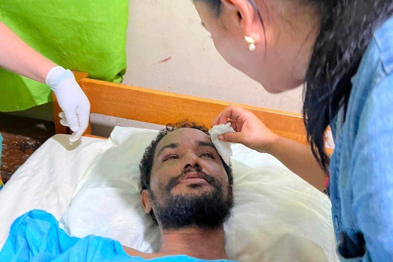 Những người sống sót trong rừng Amazon nhờ…ăn giun, quả dại - Hình 2 Nhung nguoi song sot trong rung Amazon nho…an giun, qua dai-Hinh-2