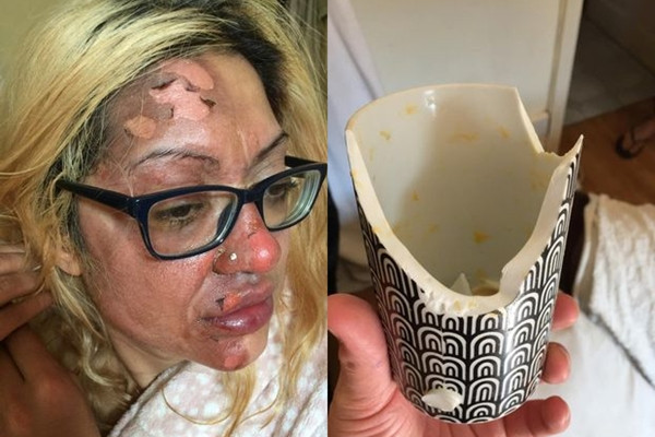 Bat chuoc meo nau an tren TikTok, nguoi phu nu bong nua mat