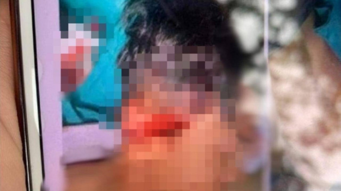 Thanh Hóa: Mang dao tới trường, chém trọng thương bạn cùng lớp Thanh Hoa: Mang dao toi truong, chem trong thuong ban cung lop