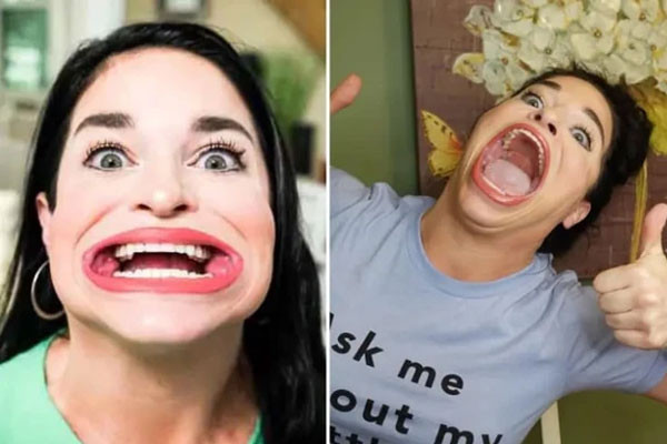 Nguoi phu nu kiem duoc tien ty nho chiec mieng rong