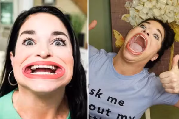 Nguoi phu nu kiem duoc tien ty nho chiec mieng rong