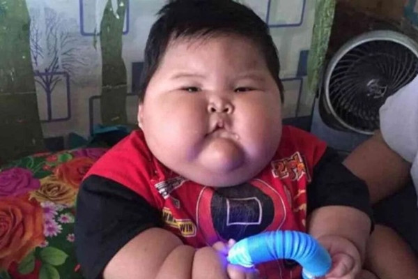 Be trai 1 tuoi beo phi nang 27kg, to bang be 8 tuoi-Hinh-2