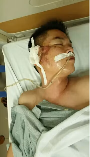 Suc khoe tai xe taxi Group bi lai xe Mazda CX5 ban gio ra sao?-Hinh-2