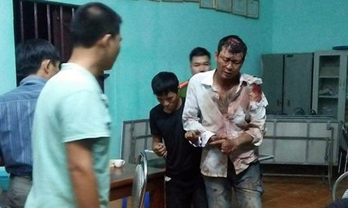 2 doi tuong di xe may tu Ha Noi len Hoa Binh trom de-Hinh-2