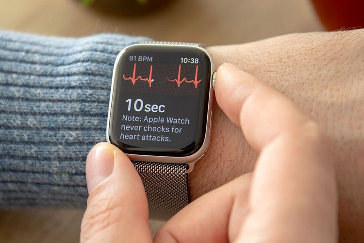 Ly do khong nen dung Apple Watch hay bat cu smartwatch nao-Hinh-2