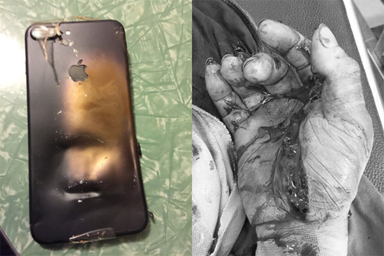 Nhung lan dien thoai no khi dang sac khien nguoi dung tu vong